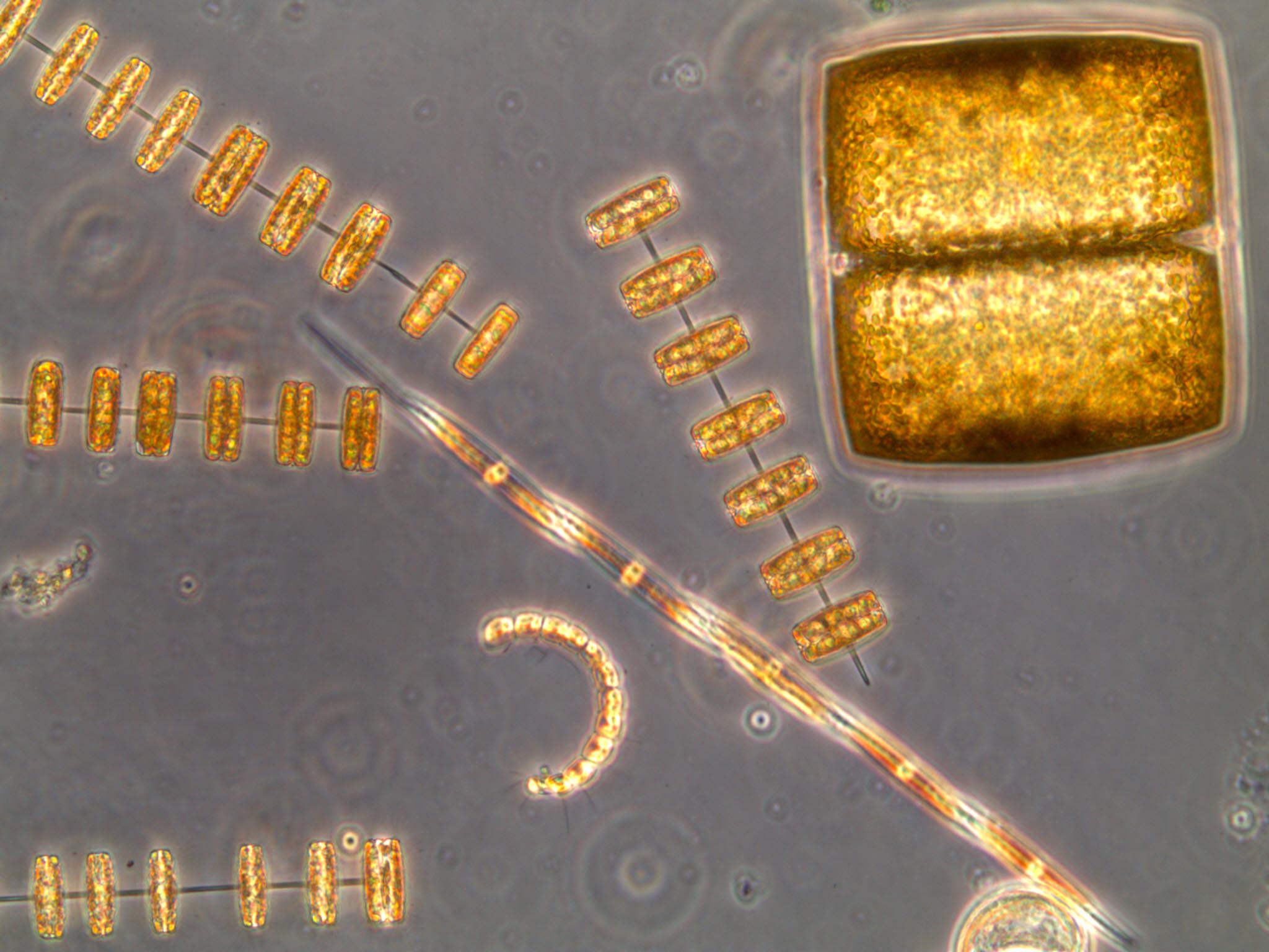 Células de diatomeas observadas al microscopio. Imagen: Isabel G. Teixeira / CSIC
