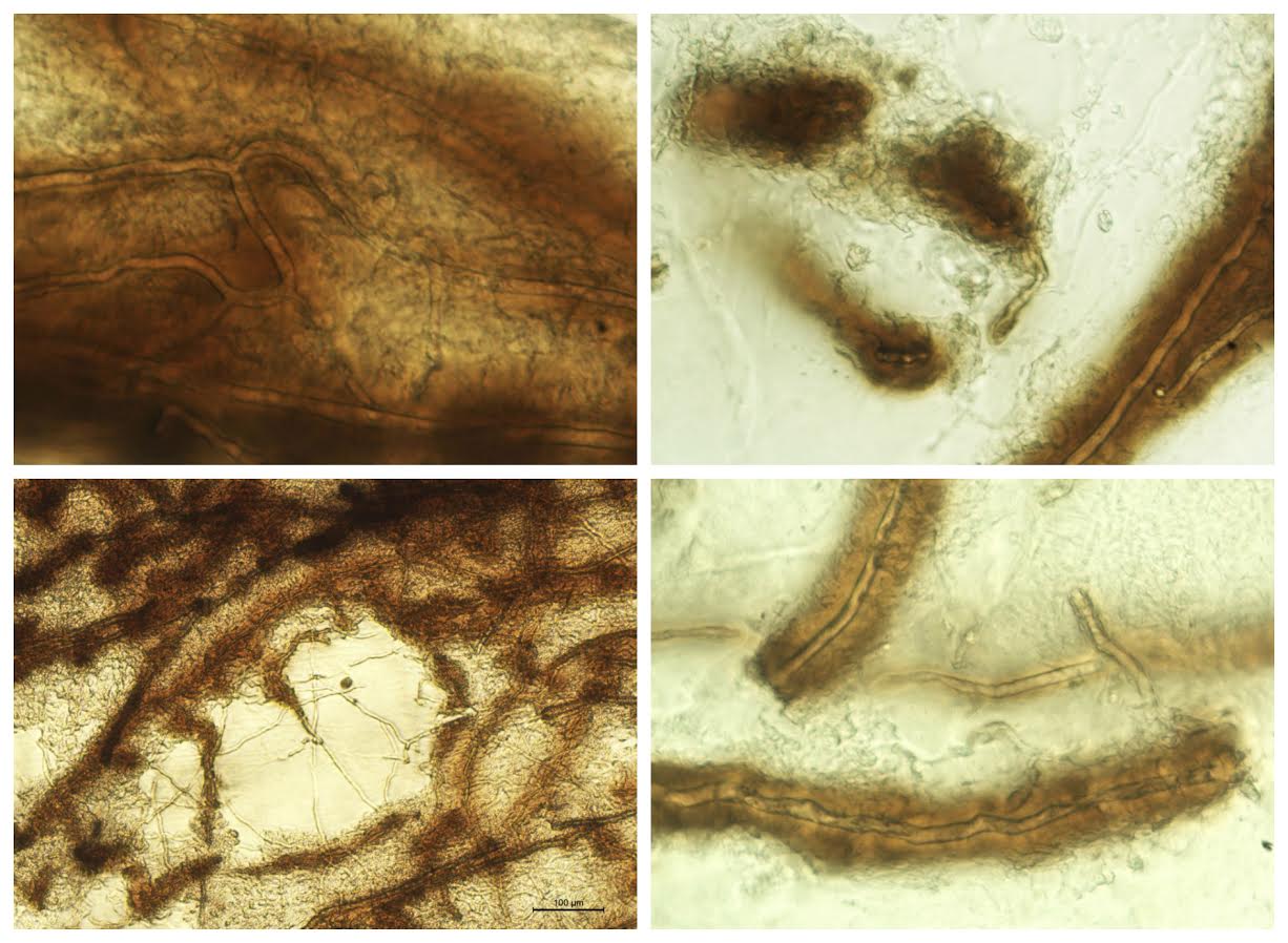 Micrografías que muestran el proceso de respuesta inmune contra Aphanomyces astaci. Foto: Laura Martín-Torrijos. (Imagen: RJB)